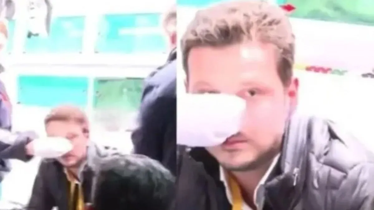 Emre Kaplan’a yapılan çirkin saldırı için net yorum: Bu ülkede hukuk var! Kalleşçe yumruk, çalışanları yıldırmaz